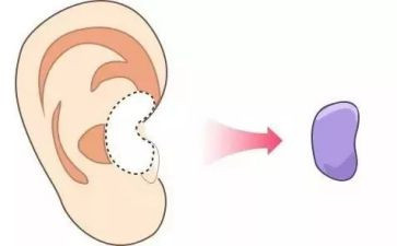 中班爱耳日健康教案5篇